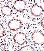 MGMT Antibody in Immunohistochemistry (Paraffin) (IHC (P))