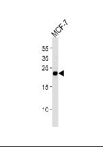 MGMT Antibody in Western Blot (WB)