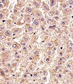 CTSD Antibody in Immunohistochemistry (Paraffin) (IHC (P))