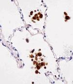 FABP4 Antibody in Immunohistochemistry (Paraffin) (IHC (P))