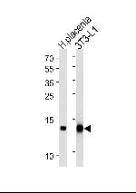 FABP4 Antibody in Western Blot (WB)