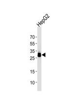 PPT1 Antibody in Western Blot (WB)