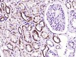 SOD2 Antibody in Immunohistochemistry (Paraffin) (IHC (P))