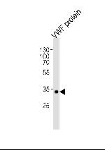 VWF Antibody in Western Blot (WB)