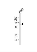 SQSTM1 Antibody in Western Blot (WB)