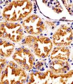 LAMP1 Antibody in Immunohistochemistry (Paraffin) (IHC (P))