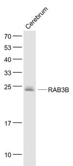RAB3B Antibody in Western Blot (WB)