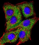 TIMP2 Antibody in Immunocytochemistry (ICC/IF)