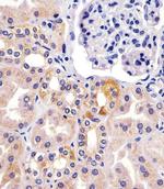 TIMP2 Antibody in Immunohistochemistry (Paraffin) (IHC (P))