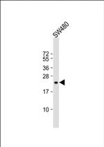 TIMP2 Antibody in Western Blot (WB)