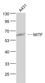 MITF Antibody in Western Blot (WB)