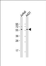 SRC Antibody in Western Blot (WB)