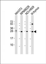 FGFR1OP2 Antibody in Western Blot (WB)