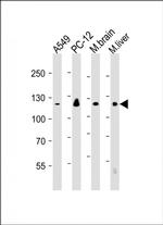 EIF2AK3 Antibody in Western Blot (WB)