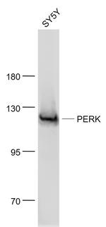 EIF2AK3 Antibody in Western Blot (WB)