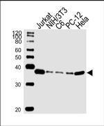 RAD51 Antibody in Western Blot (WB)
