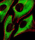 RPS6 Antibody in Immunocytochemistry (ICC/IF)
