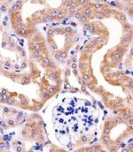 RPS6 Antibody in Immunohistochemistry (Paraffin) (IHC (P))