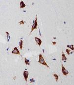 RPS6 Antibody in Immunohistochemistry (Paraffin) (IHC (P))