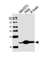 RPS6 Antibody in Western Blot (WB)