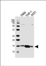 VAMP8 Antibody in Western Blot (WB)