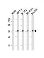 EIF2S1 Antibody in Western Blot (WB)