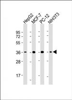 EIF2S1 Antibody in Western Blot (WB)