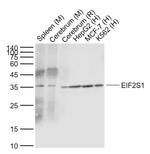 EIF2S1 Antibody in Western Blot (WB)