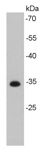 Cdk4 Antibody in Western Blot (WB)