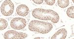 Cyclin E1 Antibody in Immunohistochemistry (Paraffin) (IHC (P))