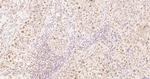 Cyclin E1 Antibody in Immunohistochemistry (Paraffin) (IHC (P))