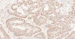 Cyclin E1 Antibody in Immunohistochemistry (Paraffin) (IHC (P))
