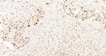 Cyclin E1 Antibody in Immunohistochemistry (Paraffin) (IHC (P))