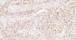 Cyclin E1 Antibody in Immunohistochemistry (Paraffin) (IHC (P))