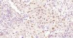 Cyclin E1 Antibody in Immunohistochemistry (Paraffin) (IHC (P))