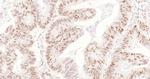 Cyclin E1 Antibody in Immunohistochemistry (Paraffin) (IHC (P))