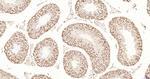 Cyclin E1 Antibody in Immunohistochemistry (Paraffin) (IHC (P))