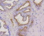 Cytokeratin 17 Antibody in Immunohistochemistry (Paraffin) (IHC (P))