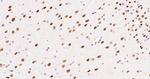 HDAC2 Antibody in Immunohistochemistry (Paraffin) (IHC (P))