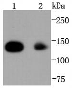 HDAC4 Antibody in Western Blot (WB)