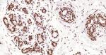 Phospho-Estrogen Receptor alpha (Ser118) Antibody in Immunohistochemistry (Paraffin) (IHC (P))