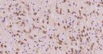 Phospho-HSF1 (Ser326) Antibody in Immunohistochemistry (Paraffin) (IHC (P))