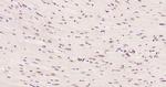 Phospho-HSF1 (Ser326) Antibody in Immunohistochemistry (Paraffin) (IHC (P))