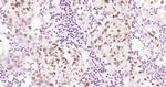 Phospho-HSF1 (Ser326) Antibody in Immunohistochemistry (Paraffin) (IHC (P))