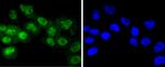 Phospho-RSK1 p90 (Thr359, Ser363) Antibody in Immunocytochemistry (ICC/IF)