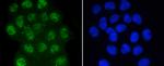 Phospho-Smad3 (Ser423, Ser425) Antibody in Immunocytochemistry (ICC/IF)