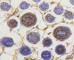 Phospho-Smad3 (Ser423, Ser425) Antibody in Immunohistochemistry (Paraffin) (IHC (P))