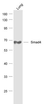 Smad4 Antibody in Western Blot (WB)