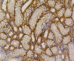 Glucose Transporter GLUT1 Antibody in Immunohistochemistry (Paraffin) (IHC (P))