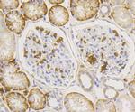 Glucose Transporter GLUT1 Antibody in Immunohistochemistry (Paraffin) (IHC (P))